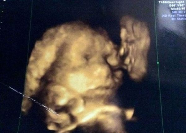 英国怀孕准妈妈4D超声波照 子宫内惊现去世曾祖父吻曾孙