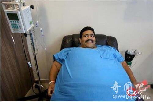 世界上最重的男人死了！死前重达450公斤！